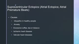 Ectopic Beats | PPT