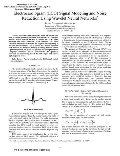 (PDF) Electrocardiogram (ECG) Signal Modeling and Noise Reduction Using ...