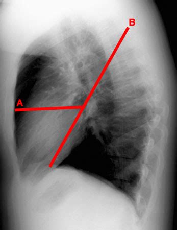 Chest Radiology