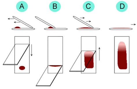 Lecture Notes in Medical Technology: Lecture #13: Morphological ...