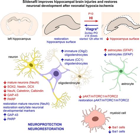 of findings. HI caused significant hippocampal atrophy and a... | Download Scientific Diagram