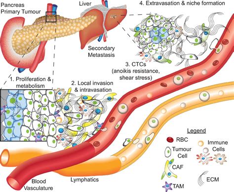 Combating pancreatic cancer with PI3K pathway inhibitors in the era of personalised medicine | Gut