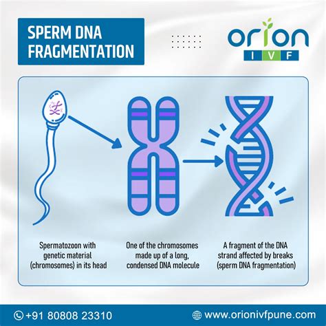 Sperm DNA fragmentation test | Orion IVF Pune - Orion IVF Pune