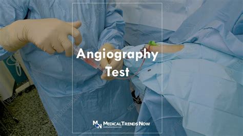 What Is an Angiography Test? Filipino Guide to Angiogram – Medical Trends Now