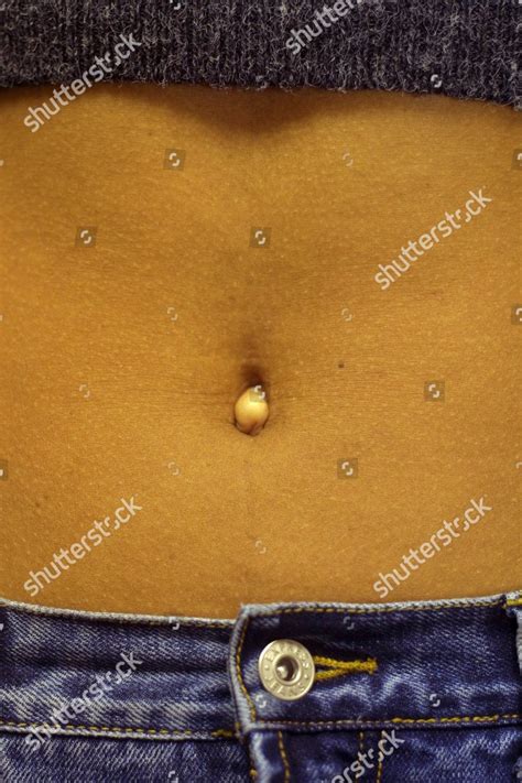 Belly Button Surgery Umbilicoplasty Becoming Popular Editorial Stock ...