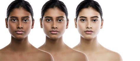 Skin Bleaching is a Symptom of a Deeper Problem | Maryoluonye.com