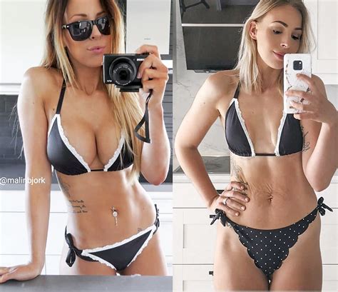 Influencer Says She's 'Proud' After Having Breast Implants Removed: 'I ...