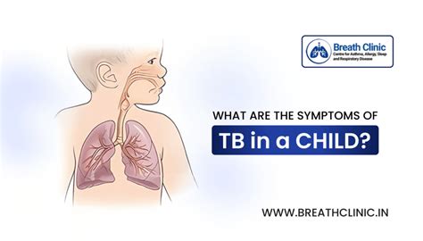 What are the Symptoms of TB in a Child in 2022? | Tuberculosis In Child