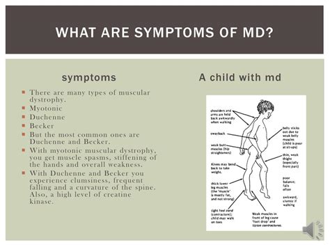 PPT - Muscular Dystrophy PowerPoint Presentation, free download - ID:2000516