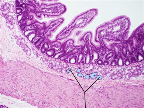 Histology of Intestines Flashcards | Quizlet