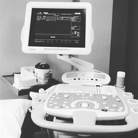 Thyroid Ultrasound Machine St. Mary's | Steven Depolo | Flickr