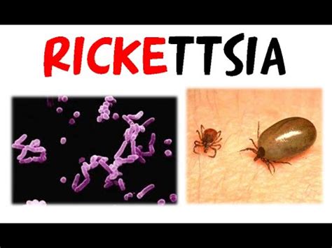 Rickettsia - YouTube