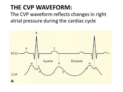 Image result for cvp waveform | Cardiac cycle, Cardiovascular system, Med school