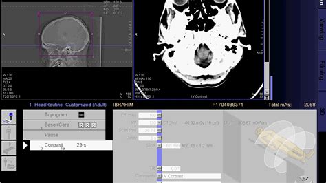 CT scan of Brain with contrast full work '"SIEMENS"' - YouTube