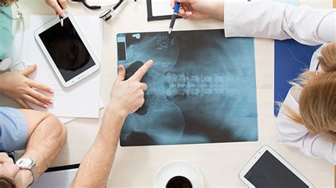 Avulsion Fracture: Causes, Symptoms, Treatment – Page 4 – Entirely Health