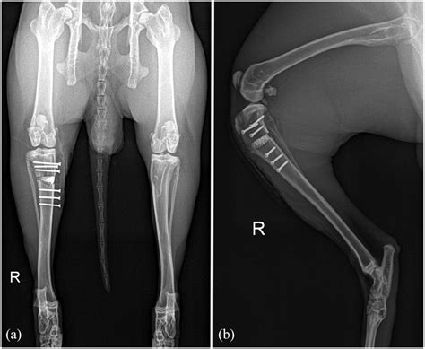 X-ray images in (a) craniocaudal and (b) mediolateral view post-op (the ...