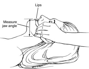 Painting crisis Council oropharyngeal airway measurement Downtown comb Peep