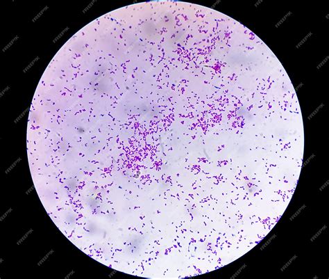 Premium Photo | Microscopic view of gram stain showing escherichia coli ...