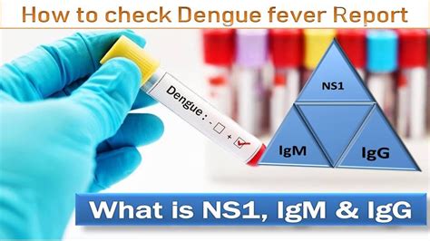 Dengue Fever Blood Tests Report Immunoglobulin, Dengue NS1 Antigen,IgM ...