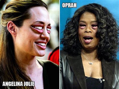 Celebrities With Mouth Eyes (18 pics)