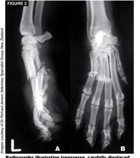 Figure 2 from Metacarpal and metatarsal fractures in dogs. | Semantic Scholar