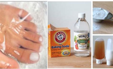 How to Cure Toenail Fungus for good-id#361182- by Budget101.com