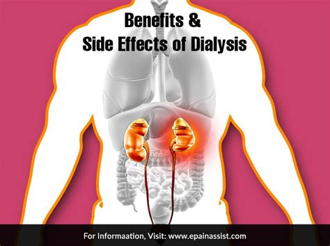 Benefits & Side Effects of Dialysis | Dialysis, Kidney dialysis ...