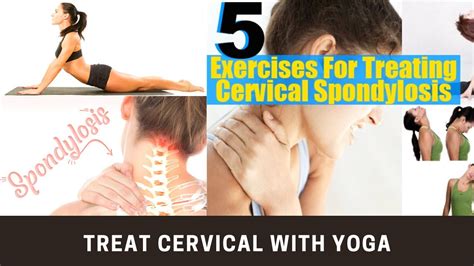 Cervical Spondylosis Stretches & Exercises- Yoga for treating neck stiffness and cervical - YouTube