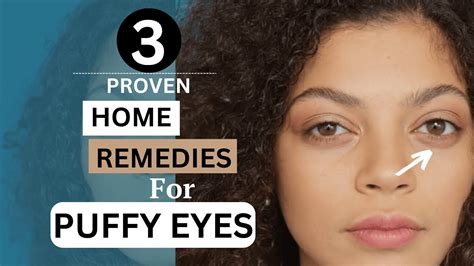 3 Proven Home Remedies For Puffy Eyes - YouTube