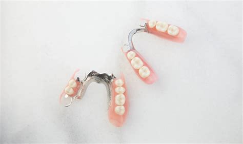 The Cost of Denture Implants