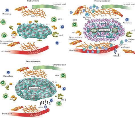 Treatment after progression in the era of immunotherapy - The Lancet ...