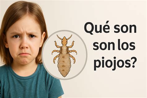 ¿Qué Son Los Piojos? | Piojos