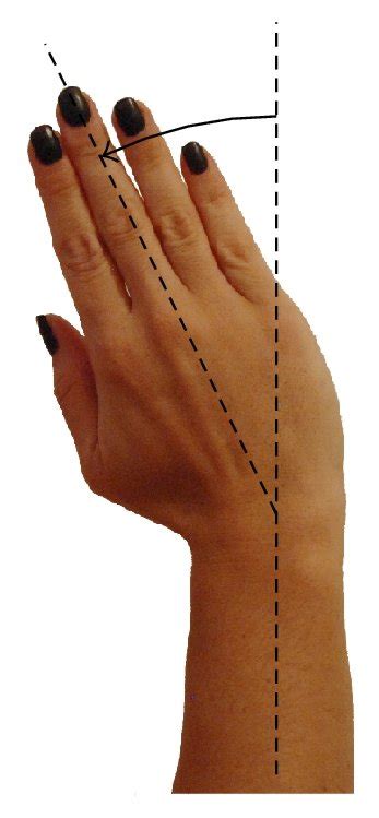 Possible movements for hand rehabilitation. (a) Extension. (b) Flexion ...