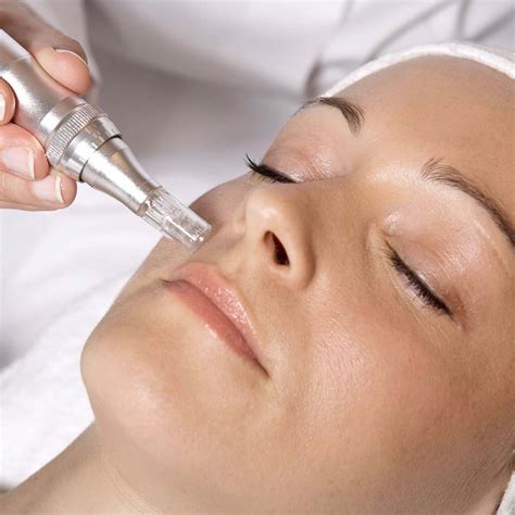 Microneedling - Dermapen - MORDI Beauty Clinic