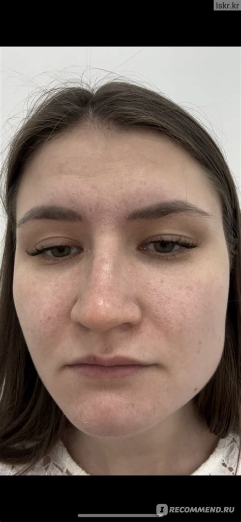 Холодная плазма - «Процедура интересная, но спорная» | отзывы