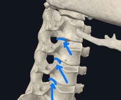 Back 2 - Joints and Muscles of Vertebrae Joints Flashcards | Quizlet