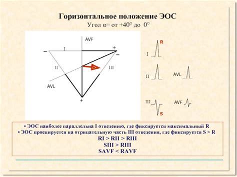 Нормальная ЭКГ