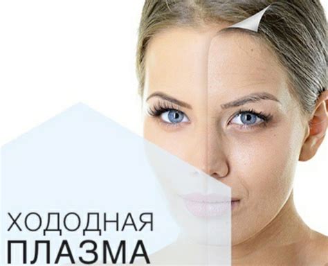 Холодная плазма - «Про боль,есть ли она. И о том, помогло ли при ...