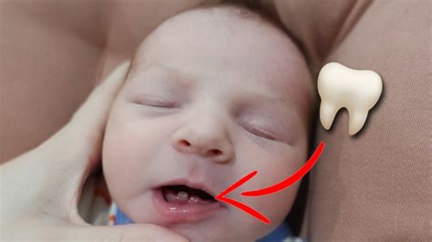 OUR NEWBORN BABY WAS BORN WITH TEETH *very rare*