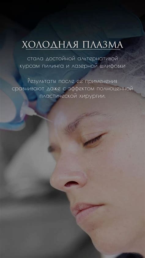 Холодная плазма