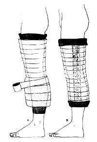 The Robert Jones Dressing | The Trauma Pro