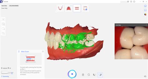 Scanner 3D Intraoral Dentaire DDS Comfort+ Graphy GRA_DDS_Comfort ...