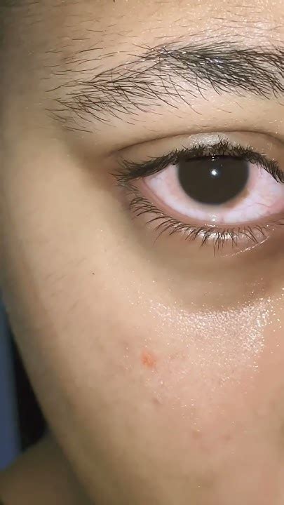 Tear stain trend - YouTube