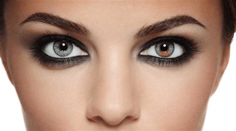 Hétérochromie ou yeux vairons - ICR Centre Ophthalmologique