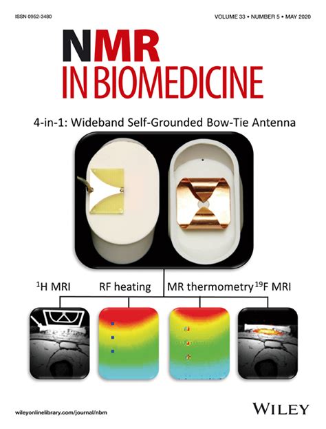 CVSnet: A machine learning approach for automated central vein sign ...