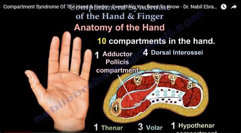 Compartment Syndrome of the Hand and Fingers — OrthopaedicPrinciples.com