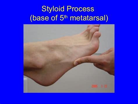 Foot surface anatomy