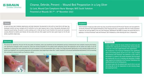 Cleanse, Debride, Prevent – Wound Bed Preparation in a Leg Ulcer ...