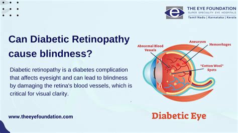 Can Diabetic Retinopathy cause blindness