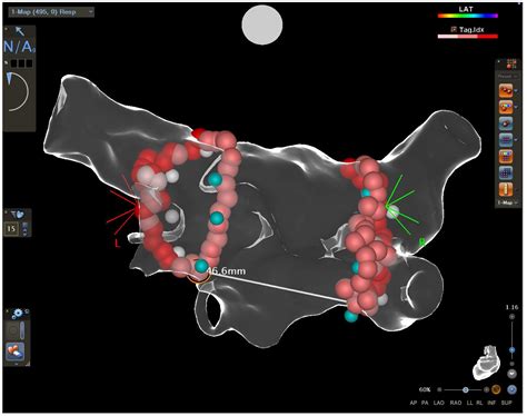 IJERPH | Free Full-Text | The Importance of a Distance between the ...